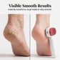 ✨📢LAST DAY SALE: Only ￡6.99!!!🔥Double-Sided Foot Scraper for Callus Removal
